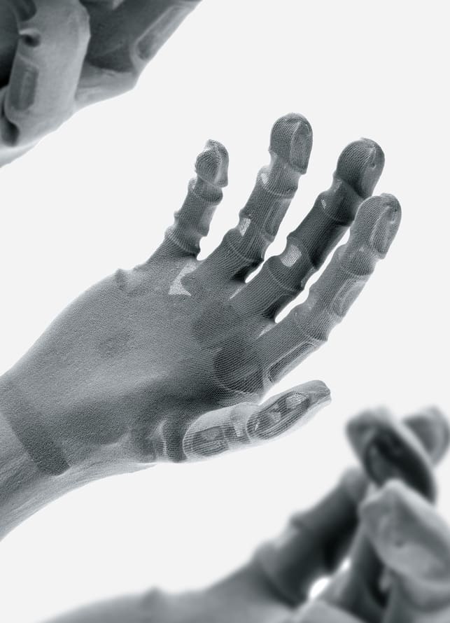 DEEDS NEWS – Leonard Neuberger – Sofia Hand Prosthesis – Photo Leonard Neuberger